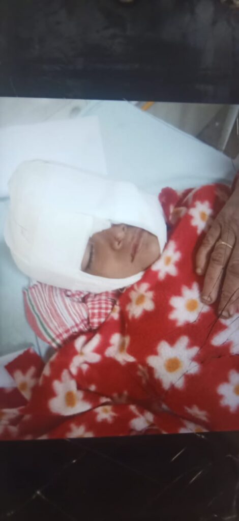 ग्वालियर शहर में आवारा कुत्तों का कहर जारी